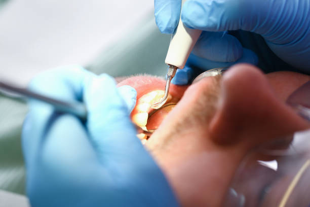 Best Root Canal Emergency Dentist  in Brass Castle, NJ